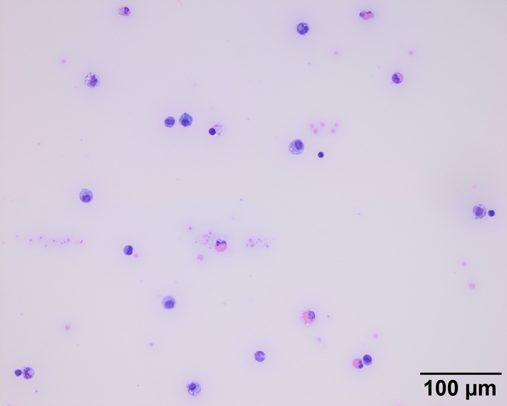 Figure 1 Synovial fluid from a horse with left front fetlock lameness