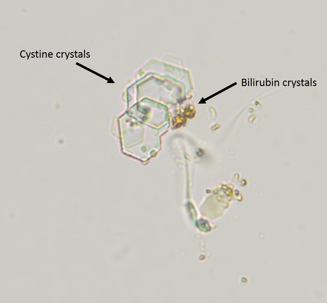 Figure 2a Urine sediment from a dog with cystine urolithiasis eClinpath