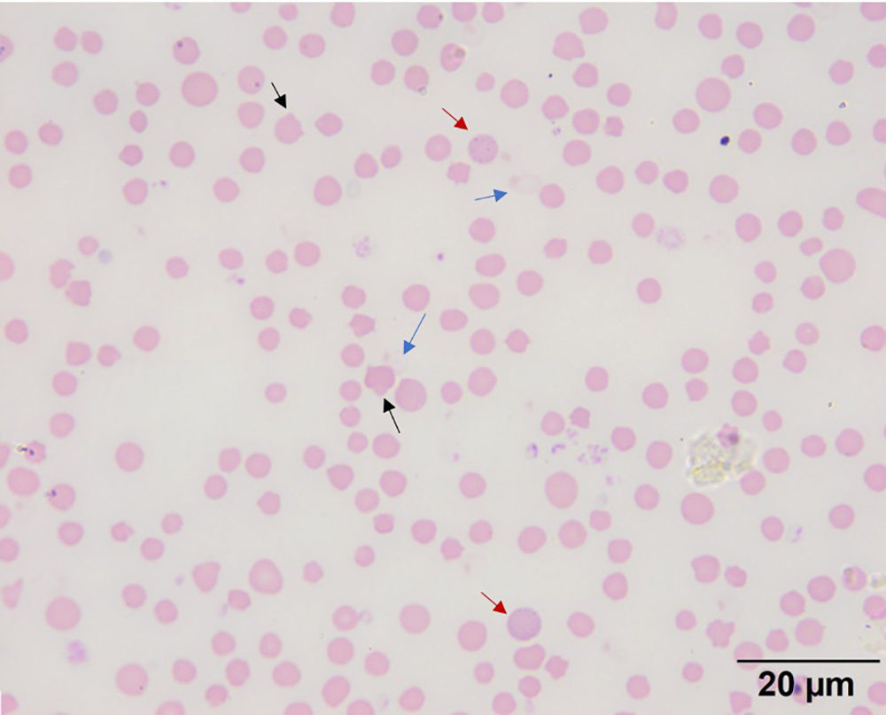 Figure 2a Blood smear from an anemic doe with copper toxicosis eClinpath