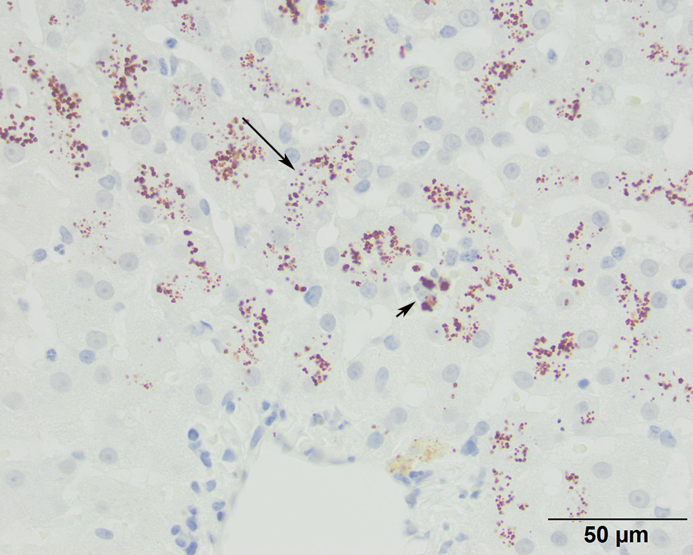 Figure 4 Histologic section of a wedge biopsy of the liver of a 2 year