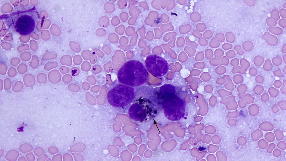 Figure 5 Scraping from a liver mass in a horse eClinpath
