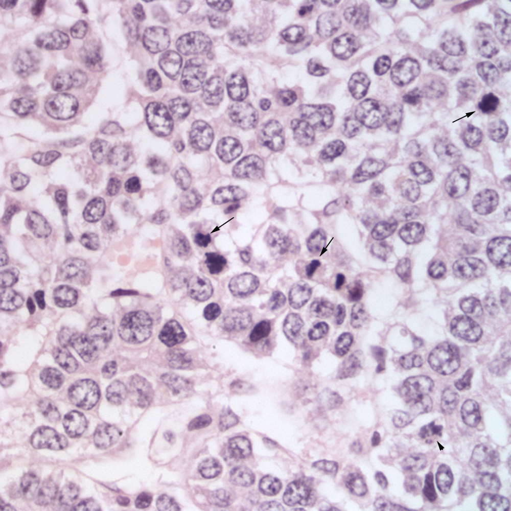 Figure 9 Histologic section of a liver mass in a horse eClinpath