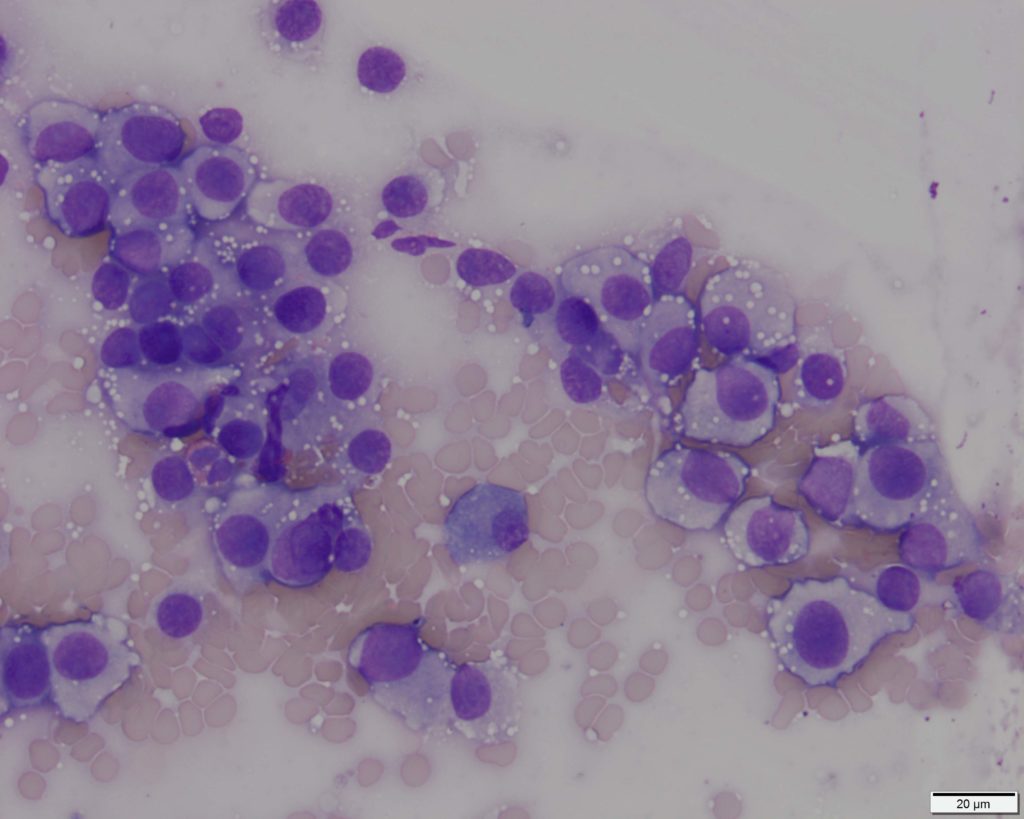 Figure 2 Impression smear from a penile mass in a dog. Wright's stain