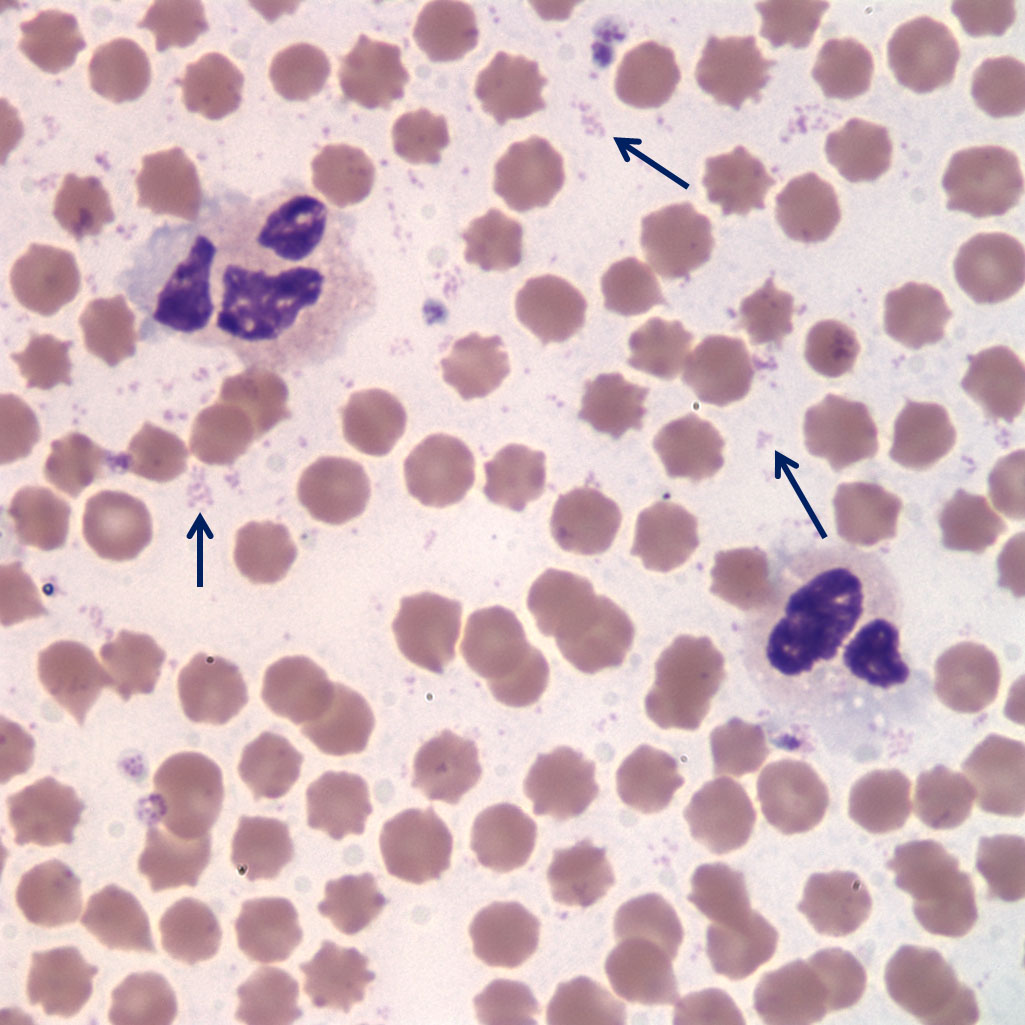 Figure 2 Blood smear from a cow with swollen teats and