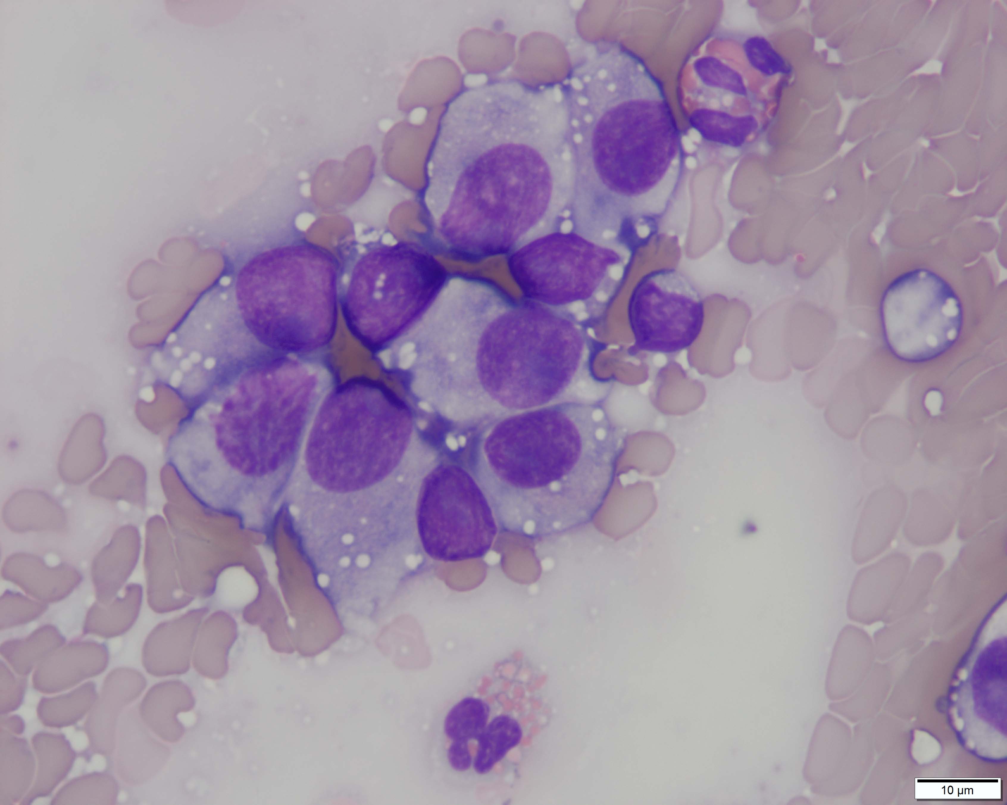 Figure 3 Impression smear from a penile mass in a dog. Wright's stain