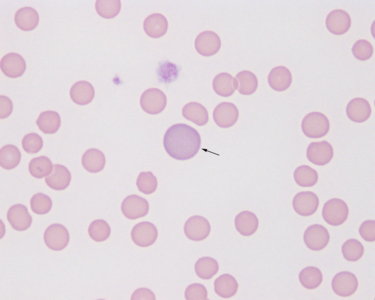 Regenerative anemia in a cat eClinpath