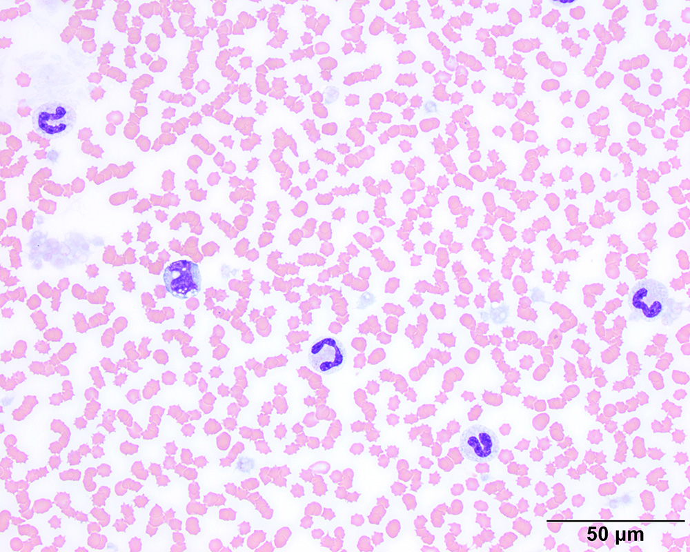 Leukogram Patterns | Eclinpath