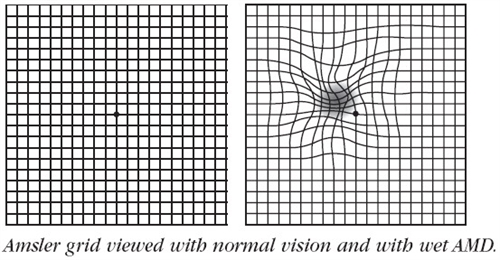 Amsler Grid for checking Macular problems