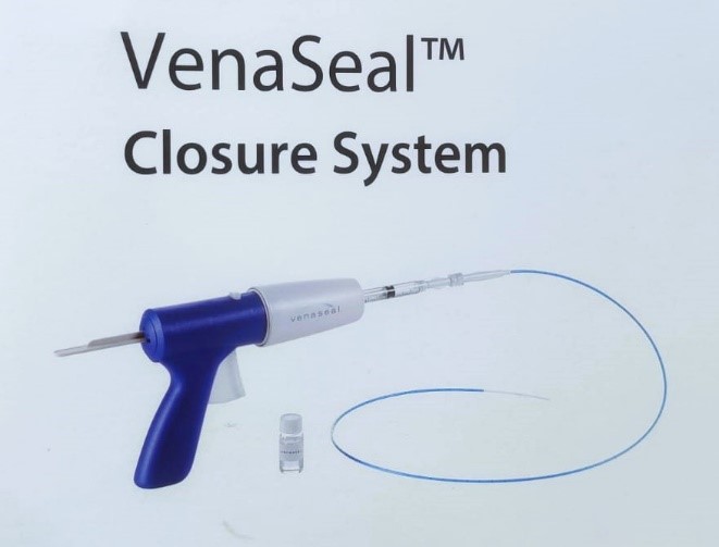 Endovenous Cyanoacrylate Glue Using VenaSeal Closure System for the