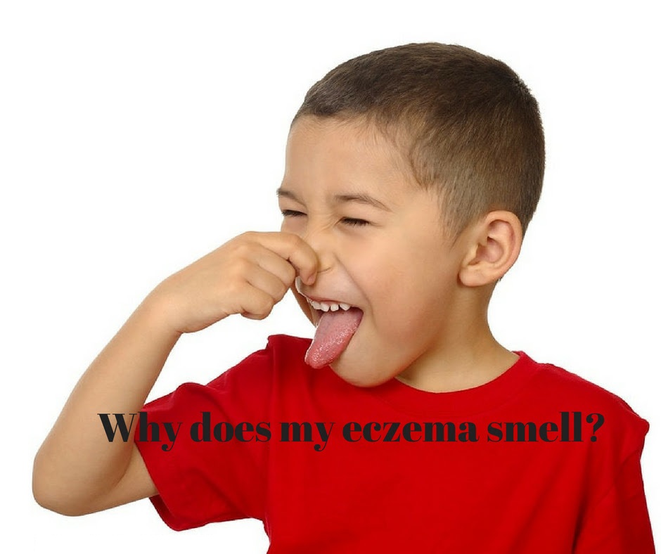 Eczema Smell Why it Smells Bad & How To Prevent It?