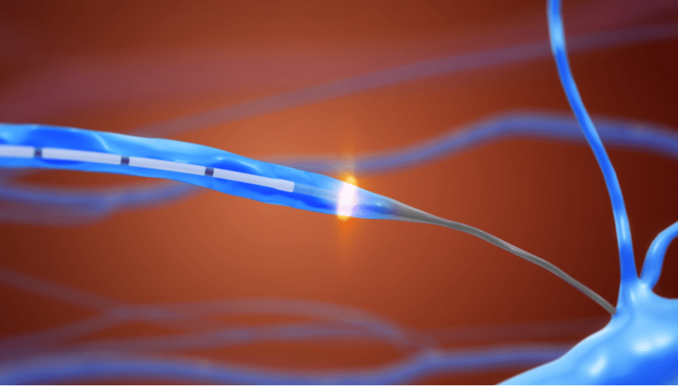 Phlebology Edge Medical