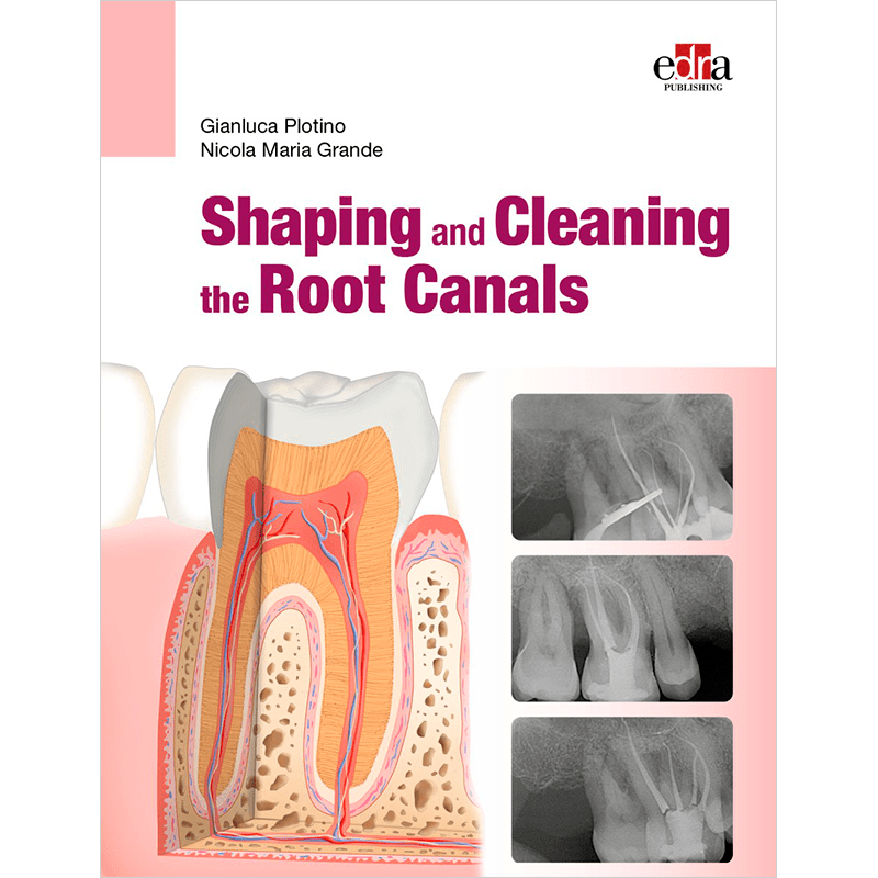 Shaping and Cleaning the Root Canals
