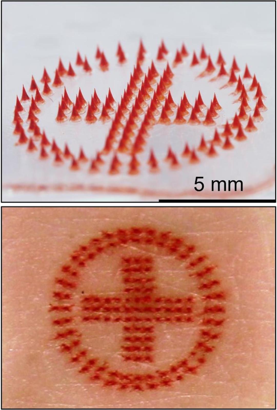 Researchers Develop Painless, Microneedle Tattoos You Can DIY At Home