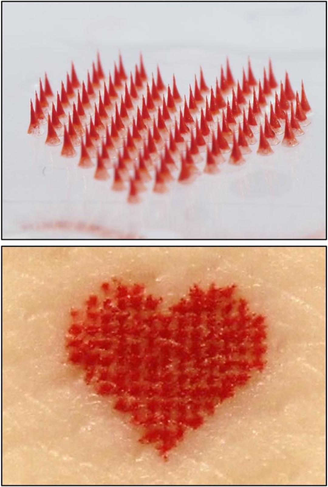 Researchers Develop Painless, Microneedle Tattoos You Can DIY At Home
