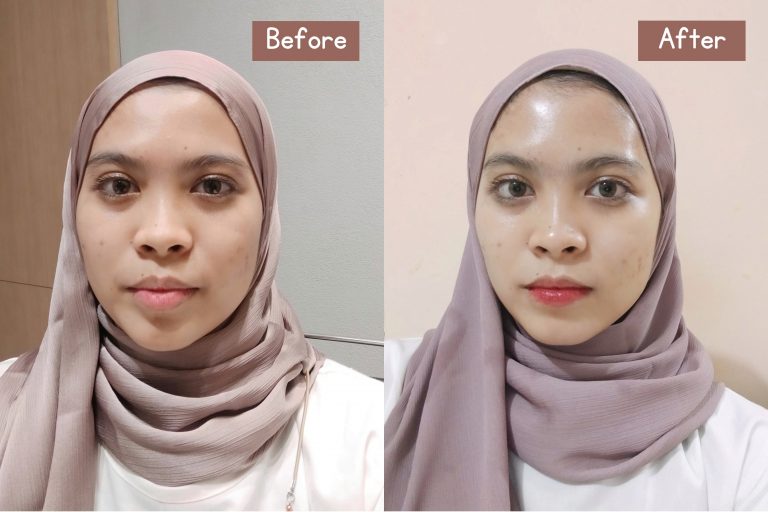 Nyobain Crystal Clear Program di ERHA, Wajah Langsung Glowing Seketika!
