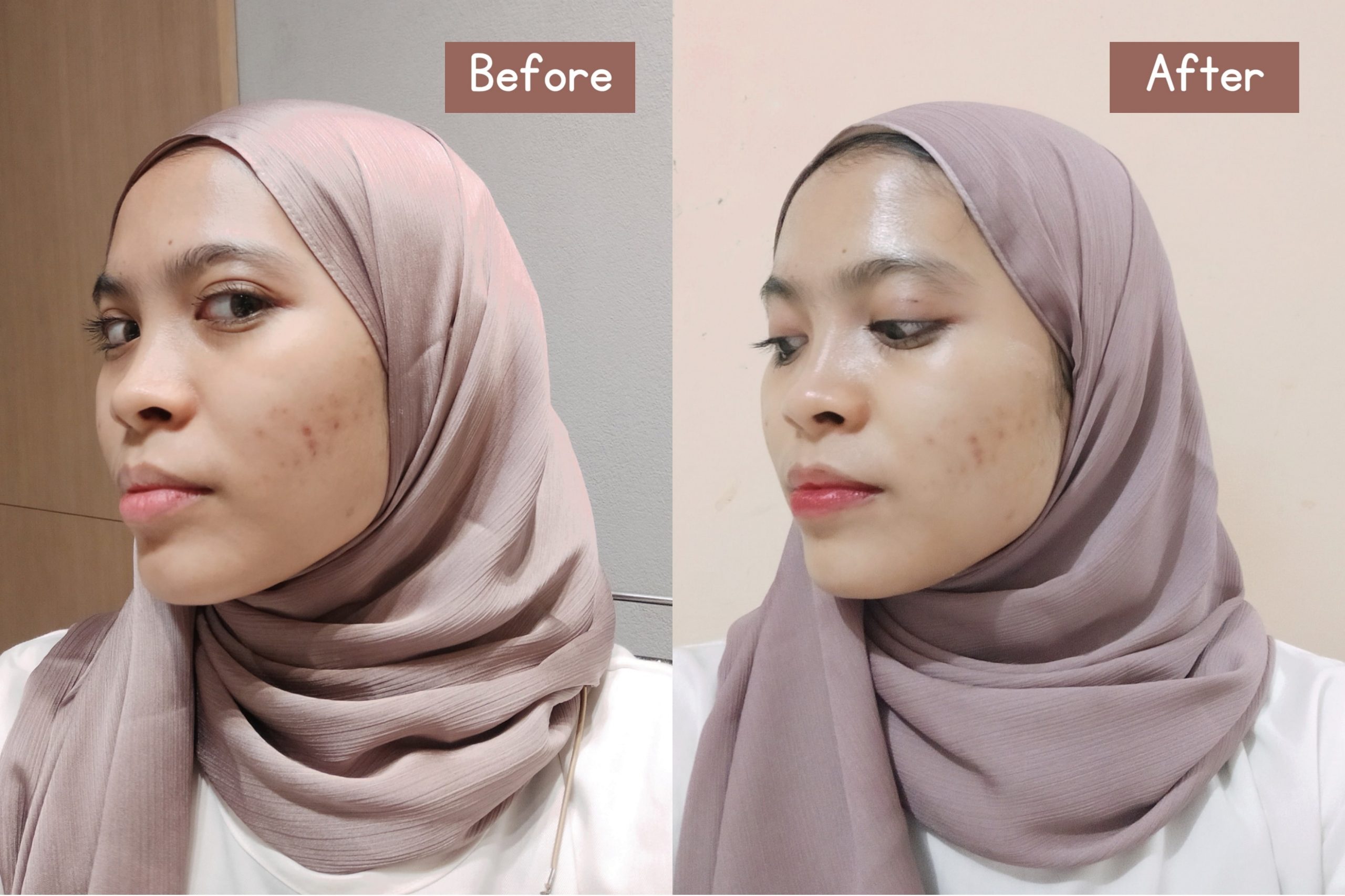 Nyobain Crystal Clear Program di ERHA, Wajah Langsung Glowing Seketika!