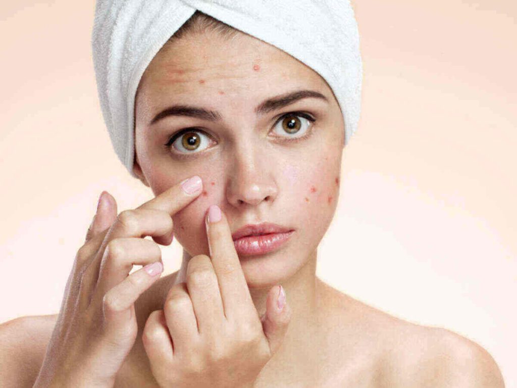 3 Best Ways to Hide Pimple Editorialge