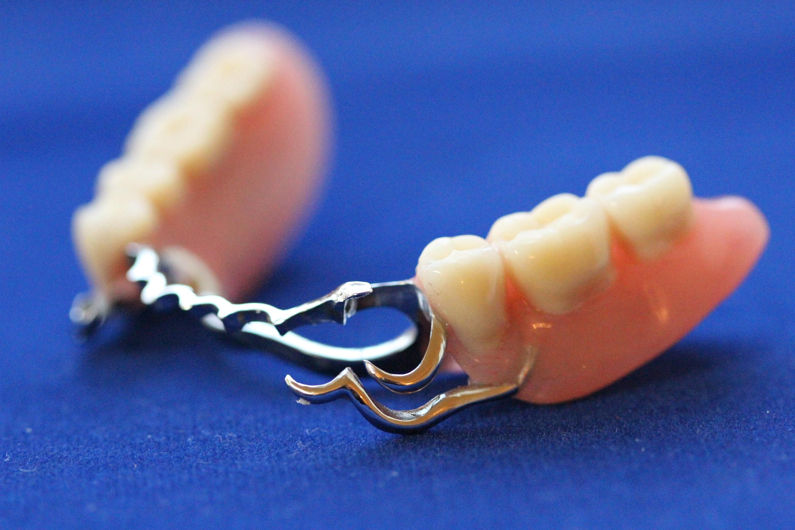 Removable prostheses EDL Dent