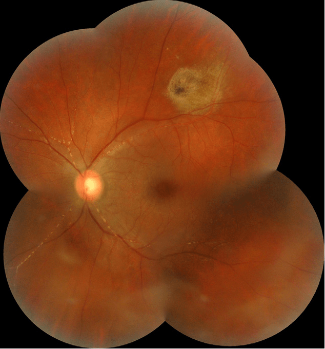 Kyrieleis Plaques Case study, Entity and Management