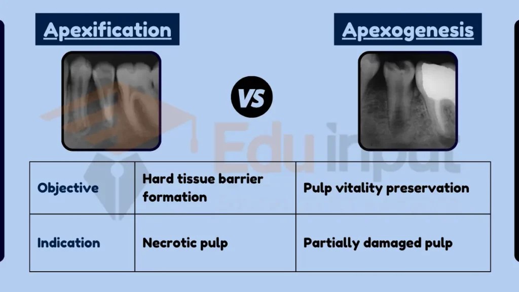 What is the Difference Between Apexification and Apexogenesis?