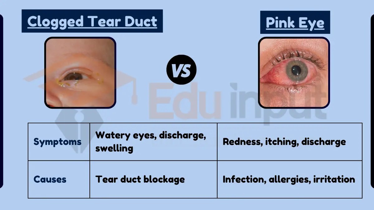 Difference Between Clogged Tear Duct and Pink Eye