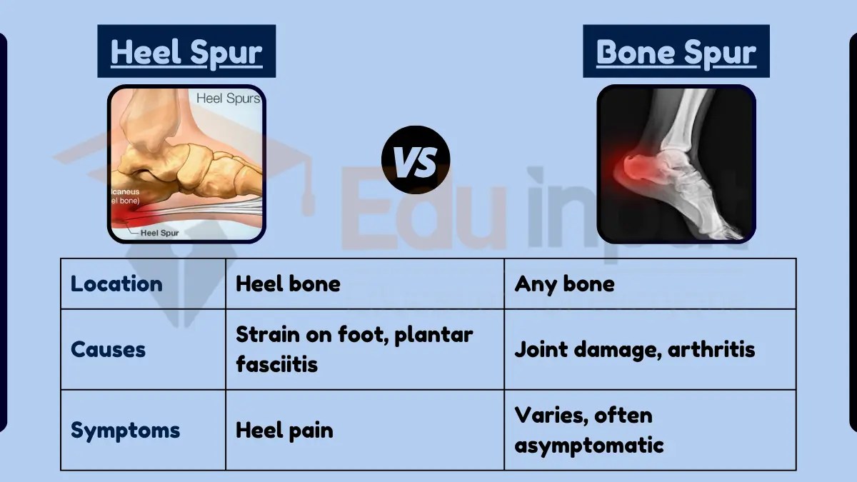 Difference Between Heel Spur and Bone Spur