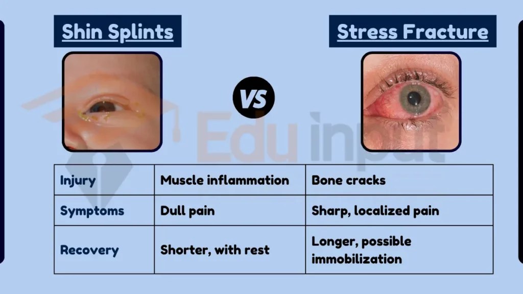 Difference Between Shin Splint and Stress Fracture