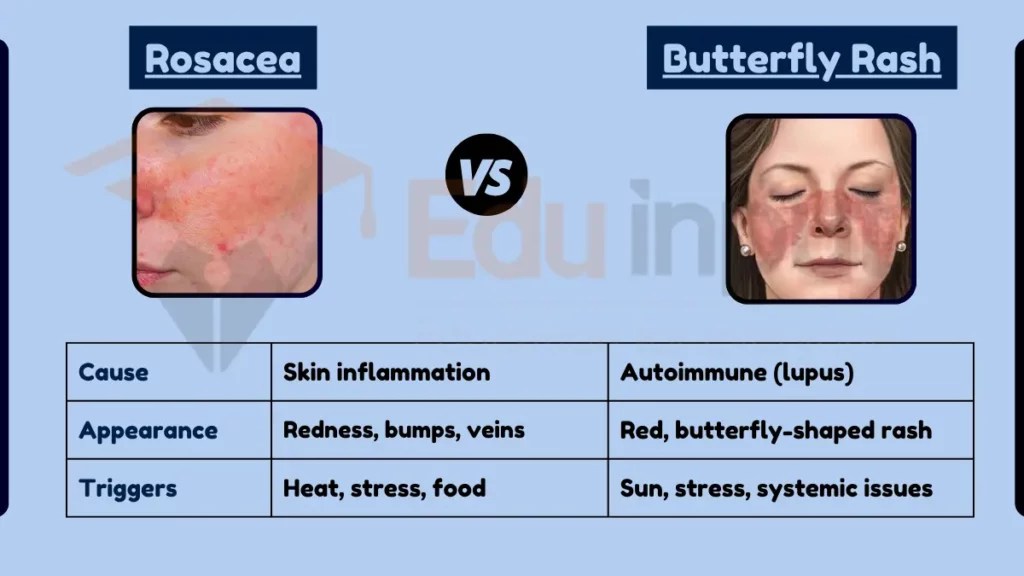 Difference Between Rosacea and Butterfly Rash?