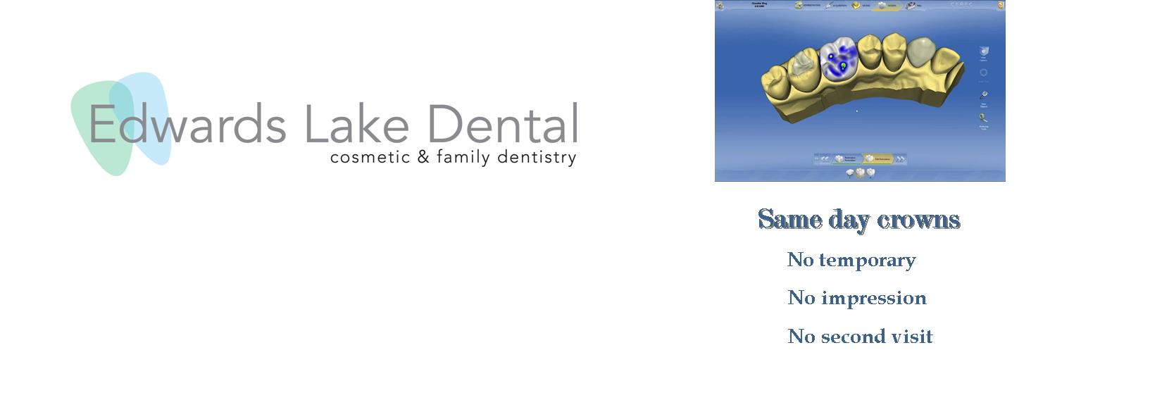 Edwards Lake Road Dentist Trussville Alabama and Birmingham AL