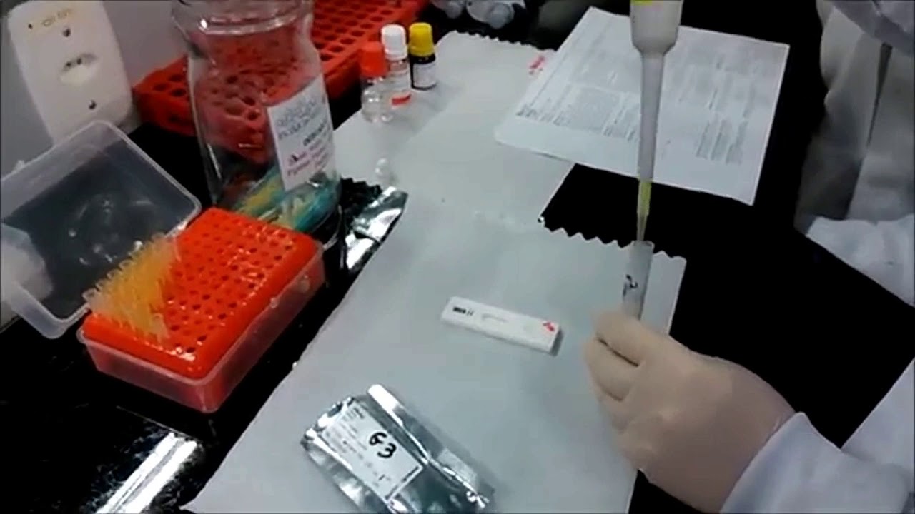 Casos de hepatitis A proliferan mientras las autoridades