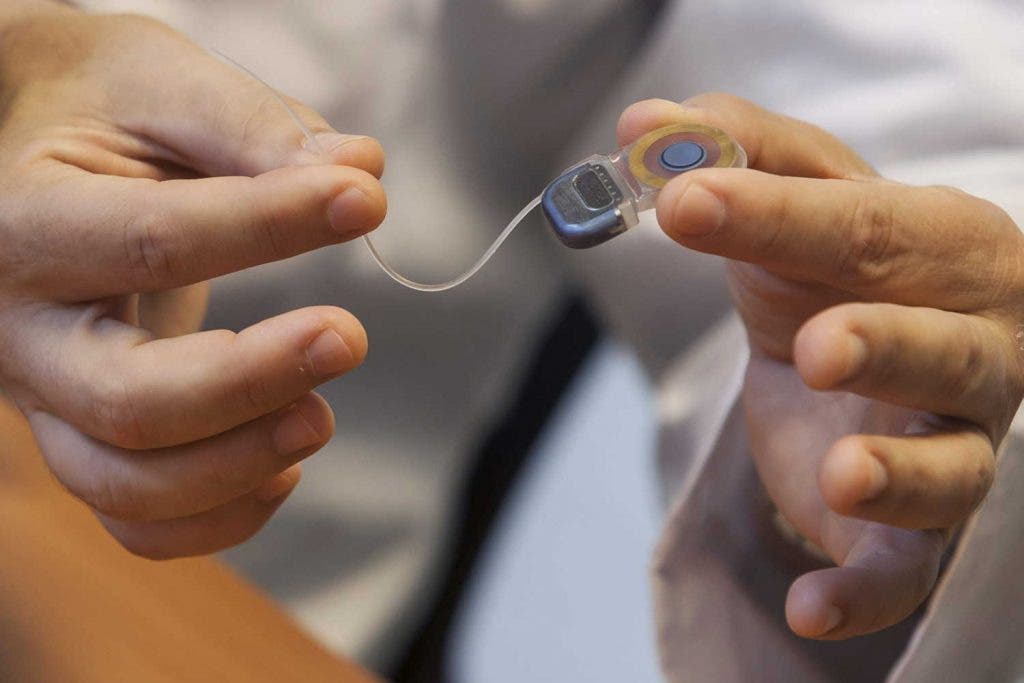 Implante coclear: también para las personas mayores Implante coclear