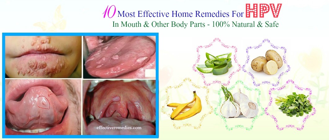Tag Archive for "Women’s Health
