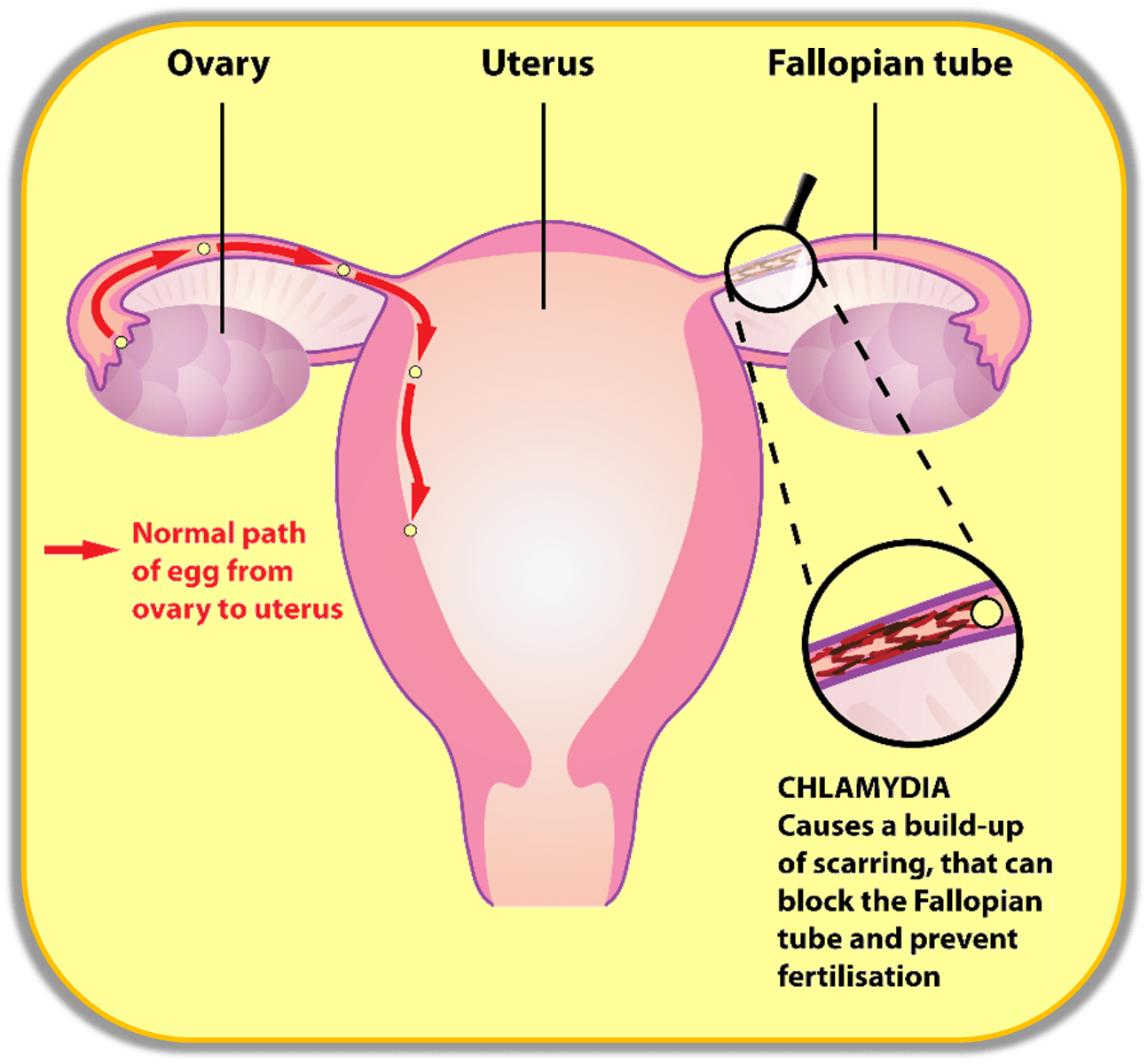 Collection 91+ Pictures Do Sperm Swim Or Crawl Stunning