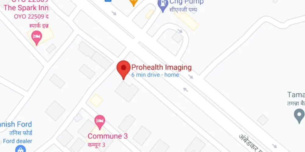 Diagnostic Tests in India Best Imaging Centre Gurgaon Delhi Noida