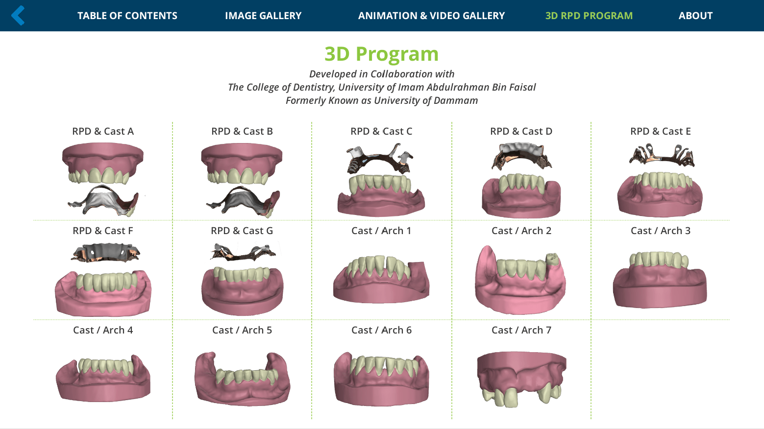 Partial Dentures Types