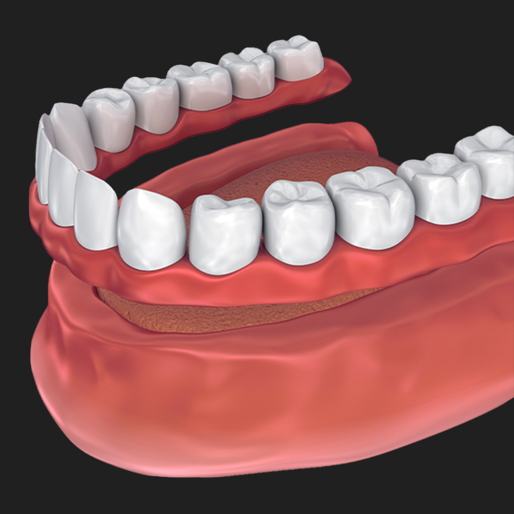 Dental Implants New Jersey Implant Dentistry NÜVA Smile