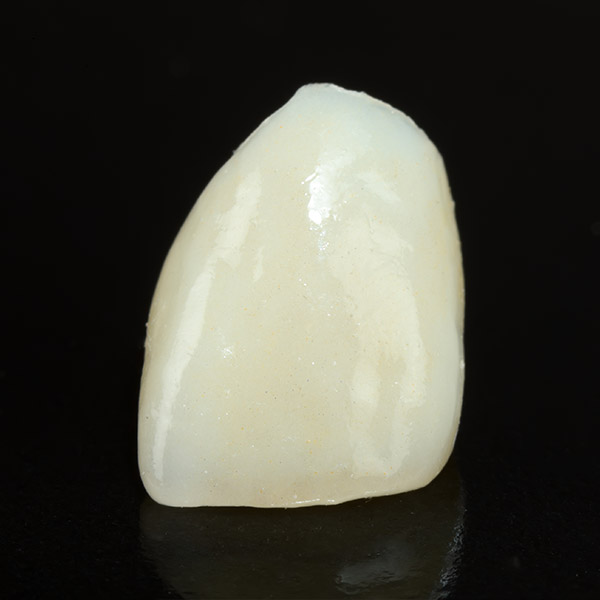 Dental Crowns Vicksburg, MS Tooth Crown Dr. Jay Measells