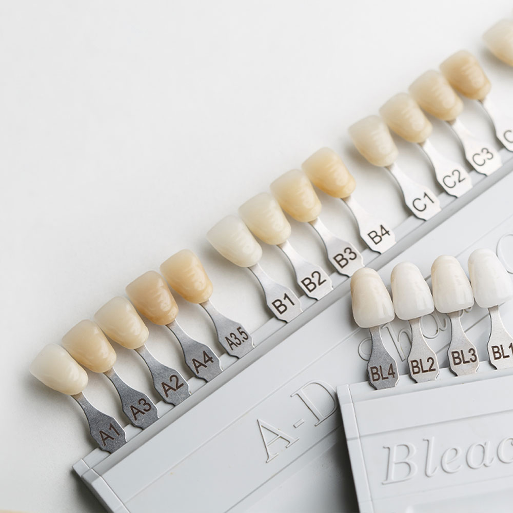 Oak Harbor Family Dentistry Dentist Slidell, LA North Shore, LA