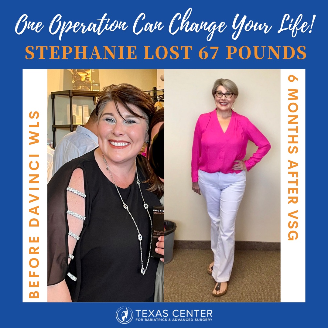Weight Loss Surgery Dallas Tx Transform Your Life