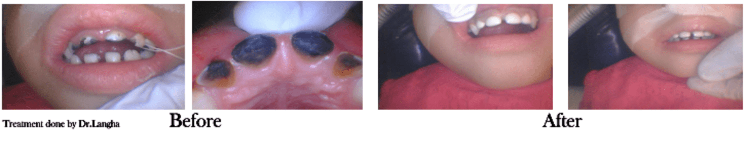Hospital Dentistry for Kids El Campo Modern Dental