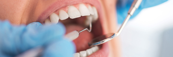 Specials El Campo Modern Dental