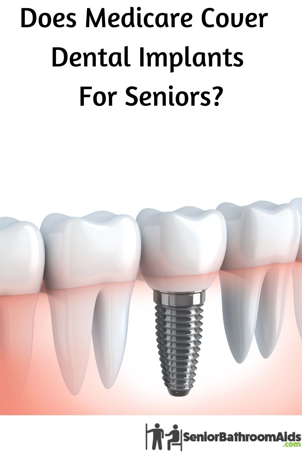 Does Medicare Cover Dental Implants For Seniors? Elderly Independence