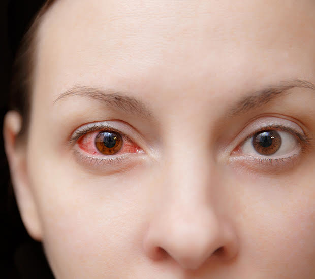 Pink Eye Treatment Houston Urgent Care