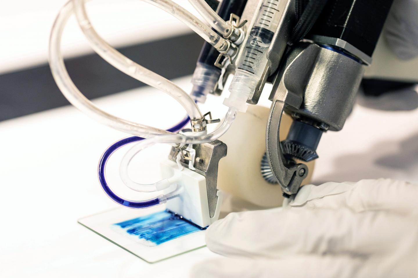 Watch Handheld 3D printer prints skin for severe burns