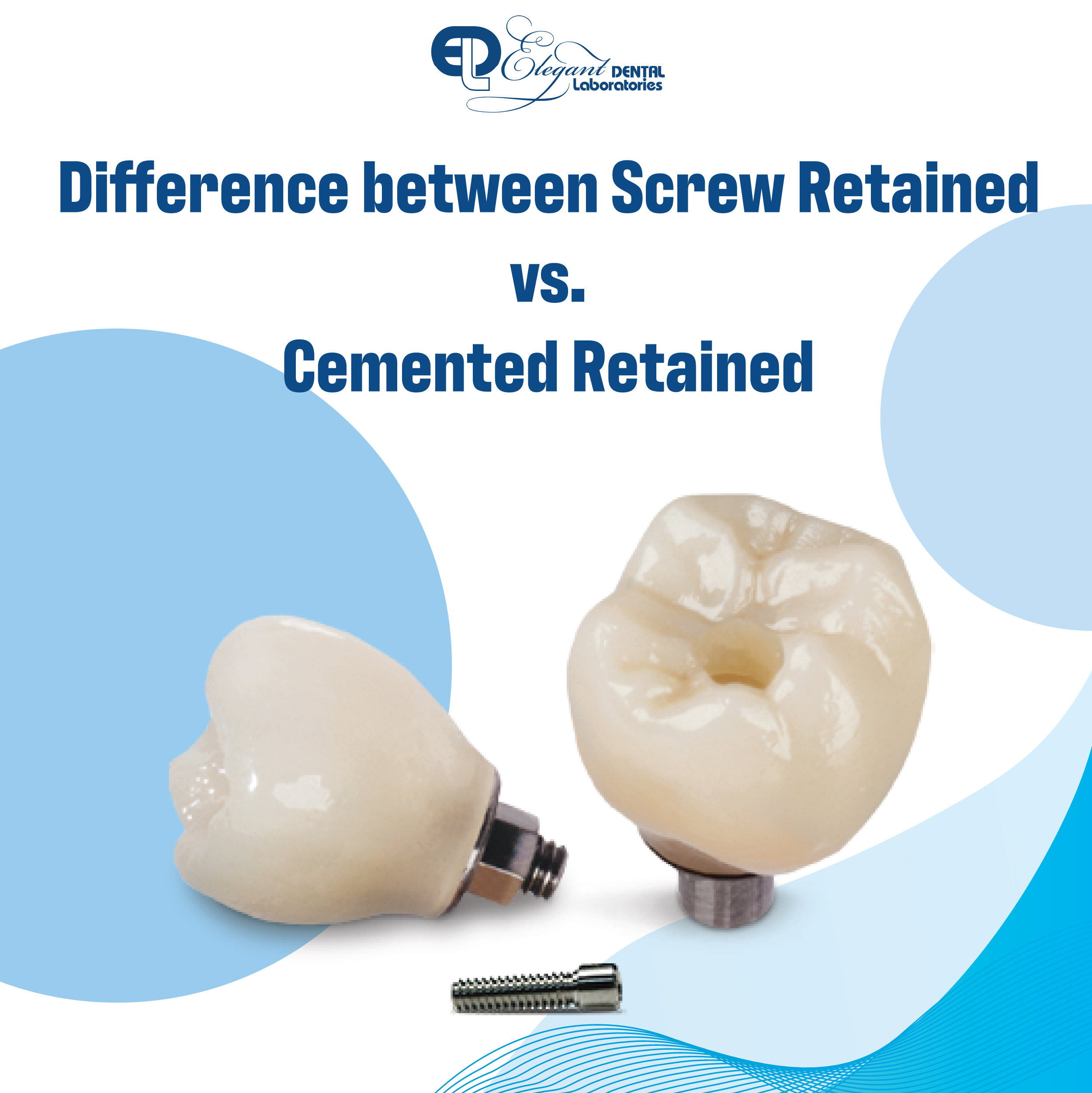 Screwretained vs. cementretained Elegant Lab
