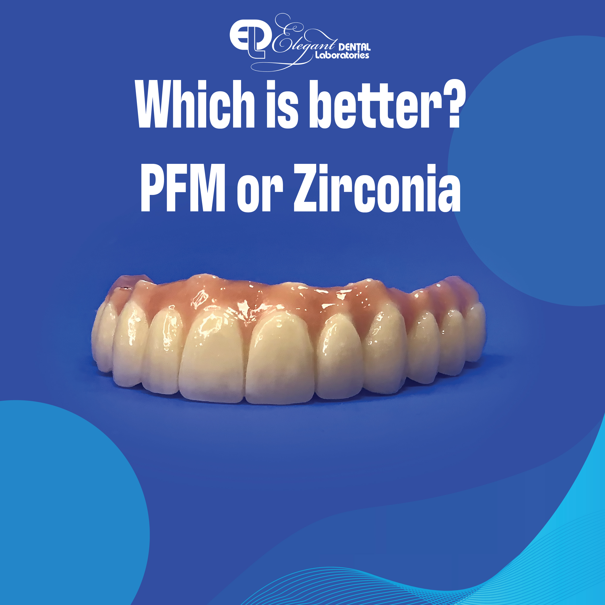 Which is better PFM or zirconia crowns? Elegant Lab