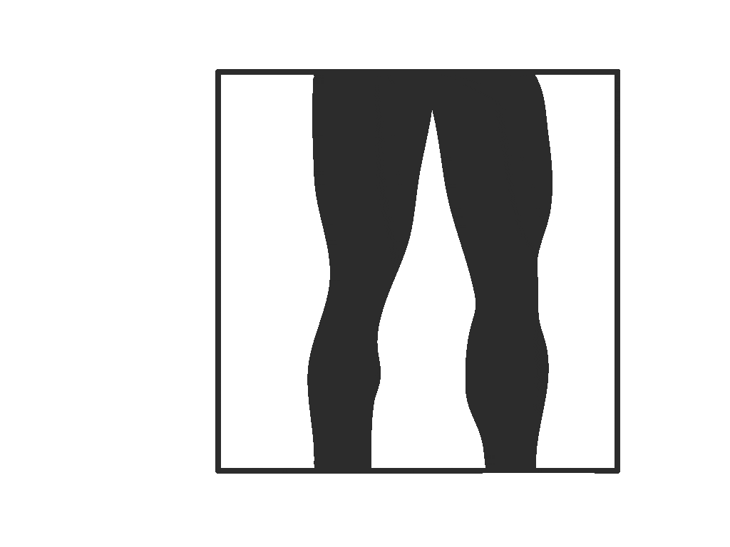 ACL injuries El Estoque