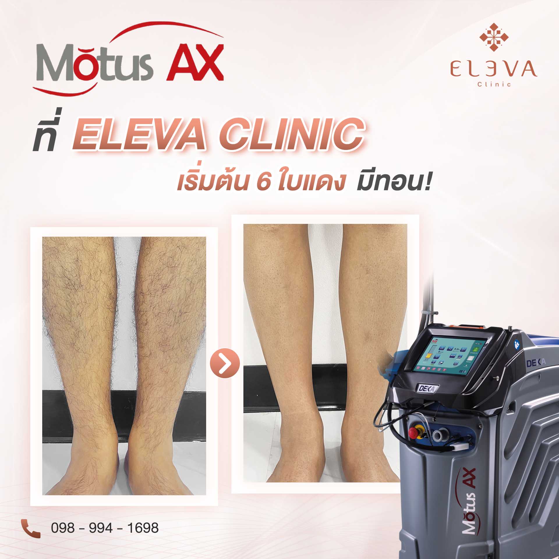 Home Eleva Clinic