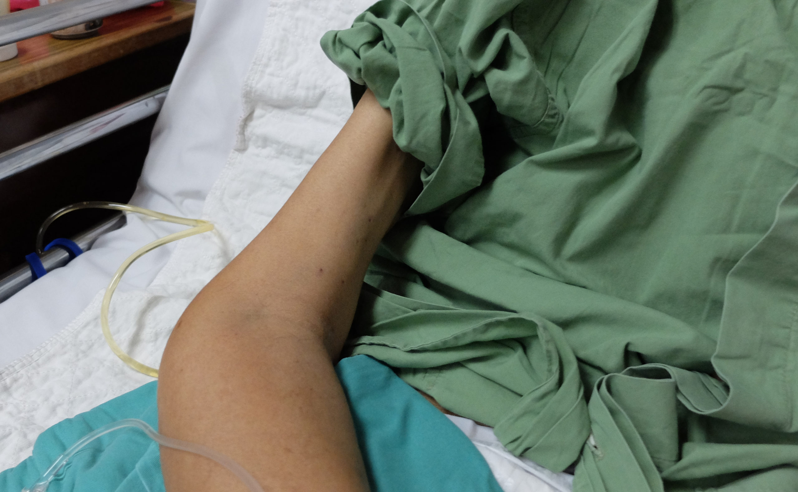 Medical Marijuana for Cachexia & Wasting Syndrome Elevate Holistics