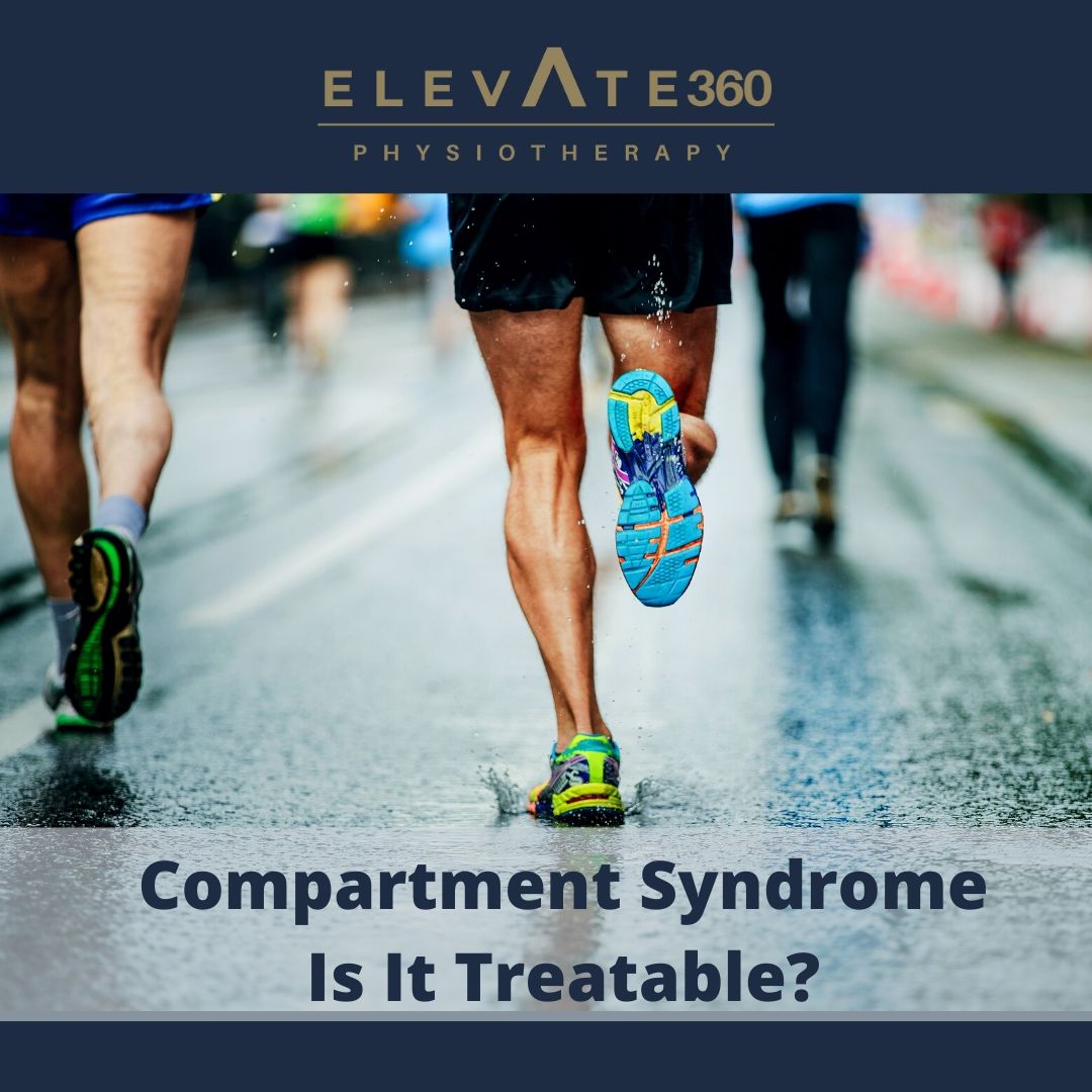 Compartment Syndrome Is It Treatable? Elevate Physiotherapy